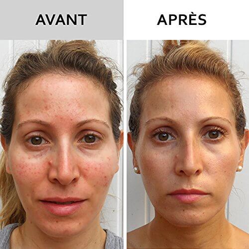 Huile d'escargot – Image 4