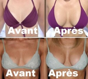 avant-après-huile fenugrec