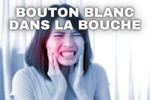 comment enlever un bouton blanc dans la bouche