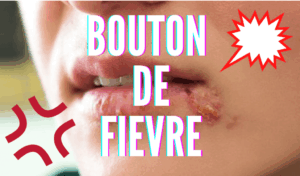 Bouton de fievre
