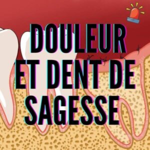 Douleur dent de sagesse