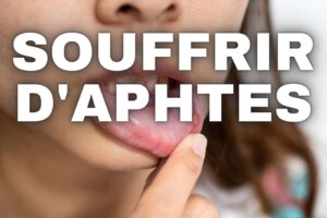 Soulager aphtes