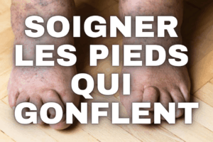 Pied qui gonflent
