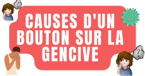 Causes d'un boutons sur la gencive 