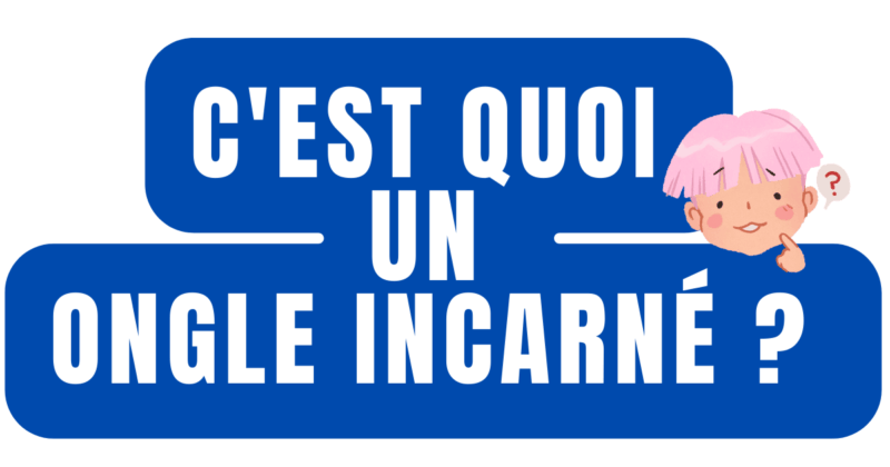 C'est quoi un ongle incarné ?
