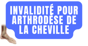 Quel taux pour une arthrodèse de la cheville ?
