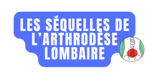 Les séquelles de l'arthrodèse lombaire