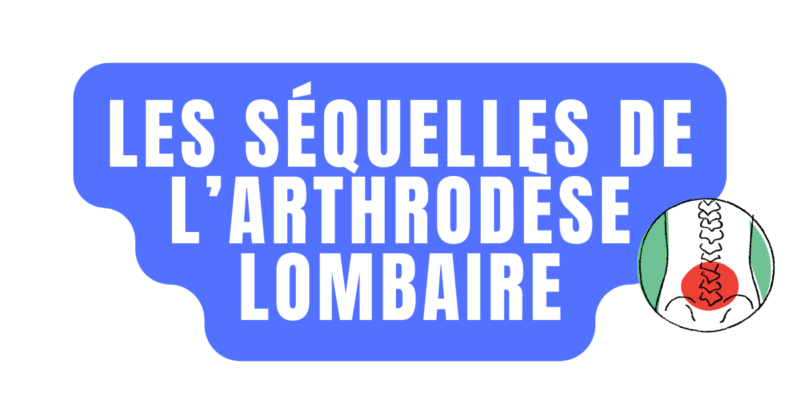 Les séquelles de l'arthrodèse lombaire