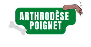 Arthrodèse poignet