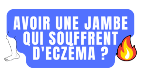 Avoir une jambe qui souffrent d'eczéma ?