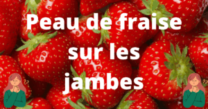 peau de fraise jambes