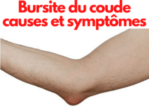 La bursite du coude causes et symptômes