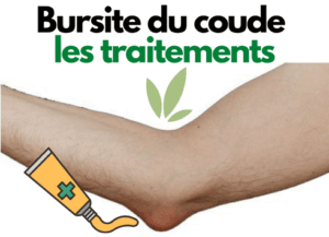 La bursite du coude les traitements