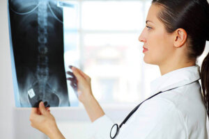 Diagnostics de la sténose foraminale